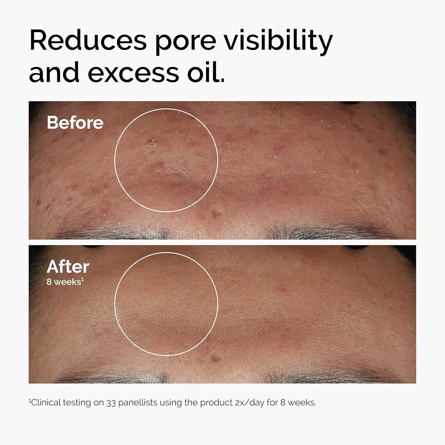 Lurxe | Niacinamide Zinc Face Serum